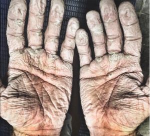 hands of an ocean paddler