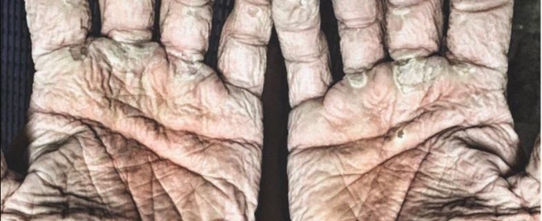 hands of an ocean paddler